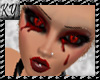 *KY* Blood Skin Normal