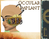 Occular Implant F