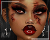 T4 | Bloody Skin 🩸