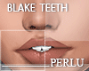 [P]Blake Teeth