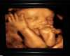 Brees Bby Boy Ultrasound