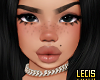 L. Freckles T1