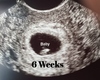 6 Week Ultrasound