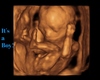It's a Boy Ultrasound
