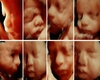 HH Ultrasound Collage