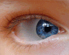 Blue Eyes