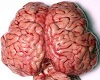 (L) Cerebro