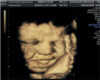 baby ultrasound frame
