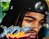 xOz Dreads w/ LA Cap '25