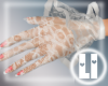 [LI] Lace Gloves w