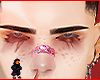 Hatcher brows