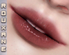 R Toxica Smile