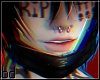 bd. septum n dimples