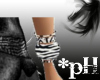 Zebra Bracelets (R)*pH