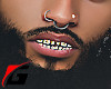 1G Gld Grillz 2