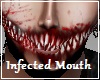 Infected Mouth