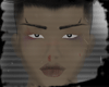 hurt T2