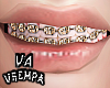 va. gold braces M