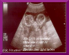 yaz baby ultrasound