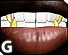 Odell Gold Teeth