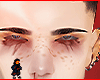 Prager brows