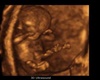 Lilah's 2 mo. Ultrasound