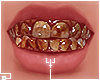 †. M Teeth 161