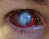 Animated eye sticker