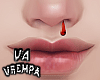 va. nose bleeding M
