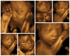 Ultrasound Collage