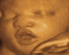 4D Ultrasound Picture