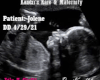 Jolene Ultrasound Pic2
