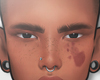 ✱ Birthmark
