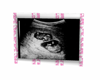 twin ultrasound pics 