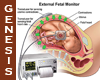 Fetal Monitor Wall Chart