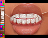  . F Teeth 04