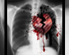 emo broken heart x-ray