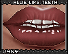 V4NY|Allie Lips Teeth3