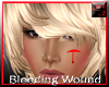 bleeding face wound