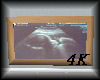 4K Baby Scan Photo