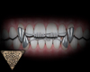 Â°My_teeth