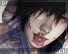 𝒔. fever