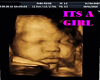 Girl Ultrasound Pic