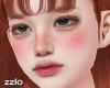 AMO diane MH