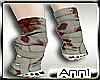 |Anni|*Bandaged feet~!o: