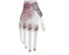 v-bruised