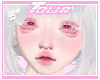 026 MH