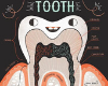 Tooth Anatomy Poster