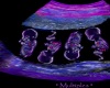 BellaPythons Ultrasound