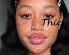 T| Freckliana